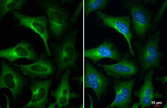 WNK1 Antibody (HL2184) - Azide and BSA Free