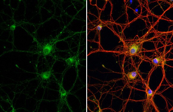 WNK1 Antibody (HL2184) - Azide and BSA Free