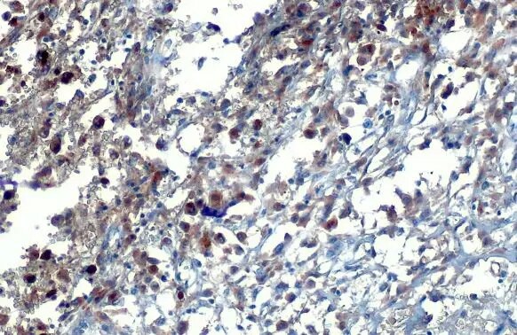 WRN Antibody (HL1729) - Azide and BSA Free