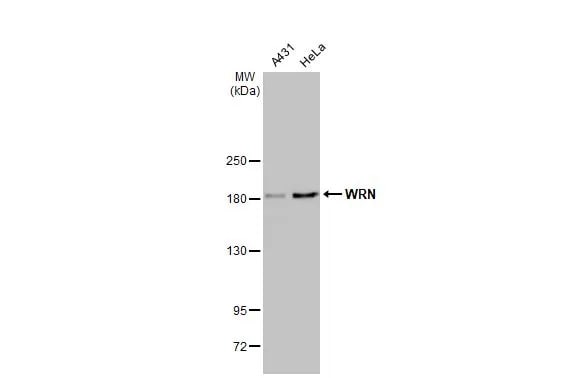 WRN Antibody (HL1729) - Azide and BSA Free