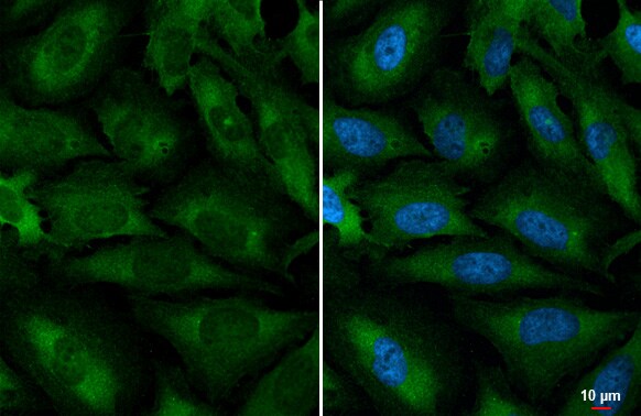 YTHDC2 Antibody (HL1861) - Azide and BSA Free