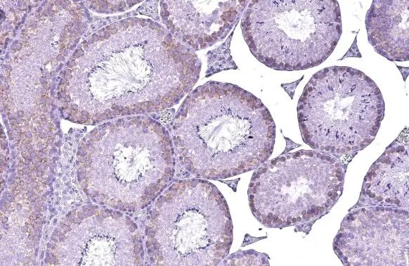 YTHDC2 Antibody (HL1862) - Azide and BSA Free