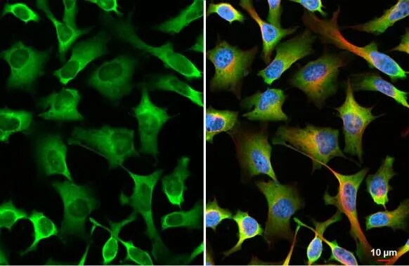 YTHDF2 Antibody (HL1354) - Azide and BSA Free