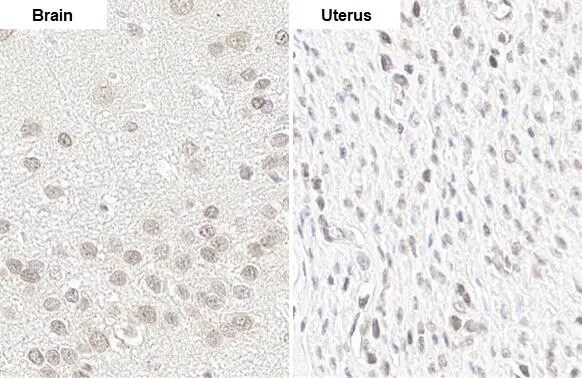 YTHDF2 Antibody (HL1354) - Azide and BSA Free