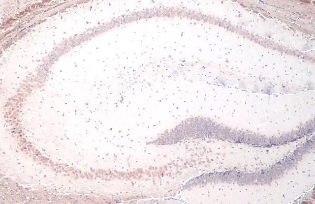 YTHDF2 Antibody (HL1354) - Azide and BSA Free