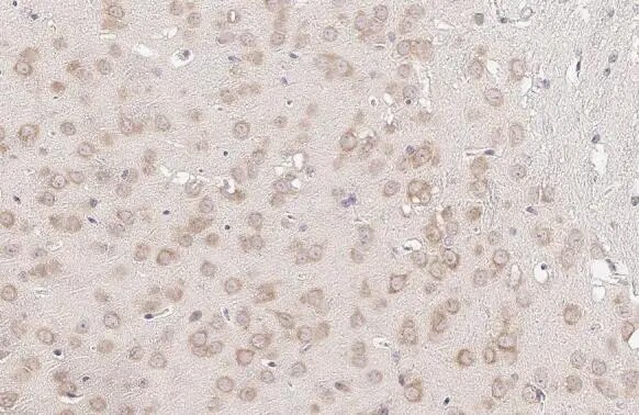YTHDF3 Antibody (HL2235) - Azide and BSA Free