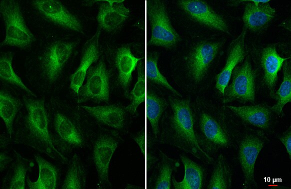 ZCCHV Antibody (HL1884) - Azide and BSA Free