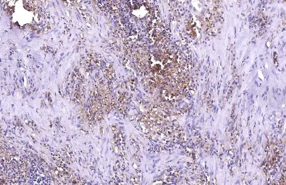 ZCCHV Antibody (HL1884) - Azide and BSA Free