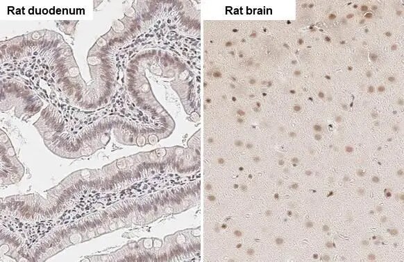 ZEB1 Antibody (HL2245) - Azide and BSA Free