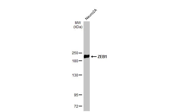 ZEB1 Antibody (HL2245) - Azide and BSA Free