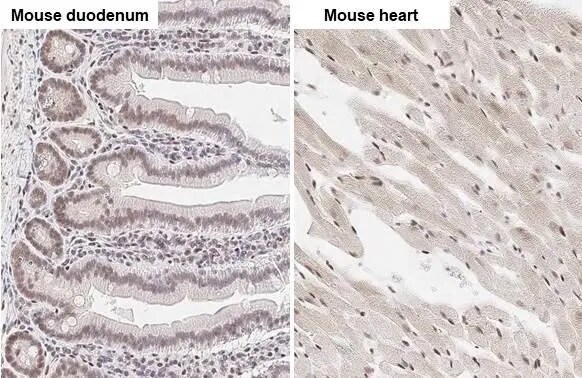 ZEB1 Antibody (HL2245) - Azide and BSA Free