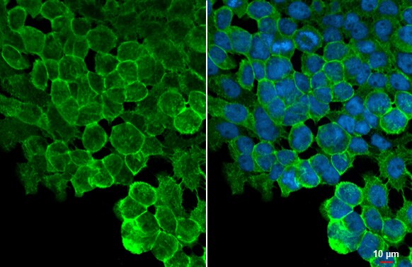 Tight Junction Protein 1 Antibody (HL1185) - Azide and BSA Free