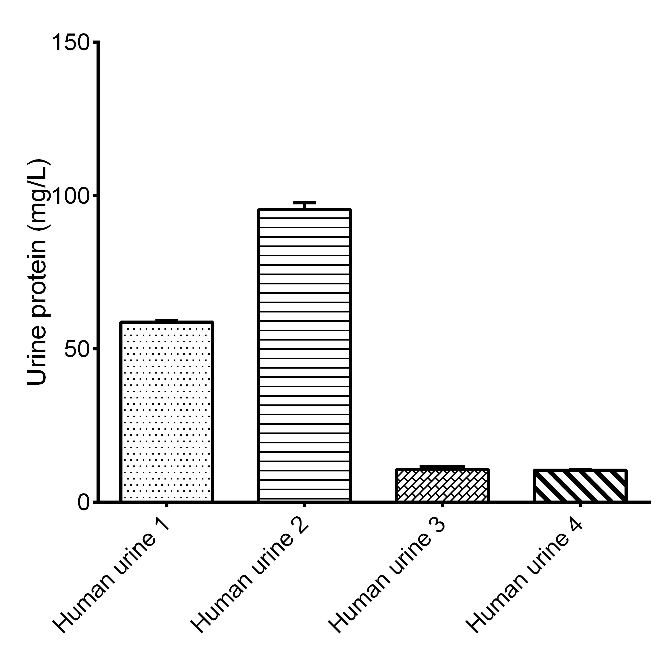 Urine Protein Assay Kit (Colorimetric)