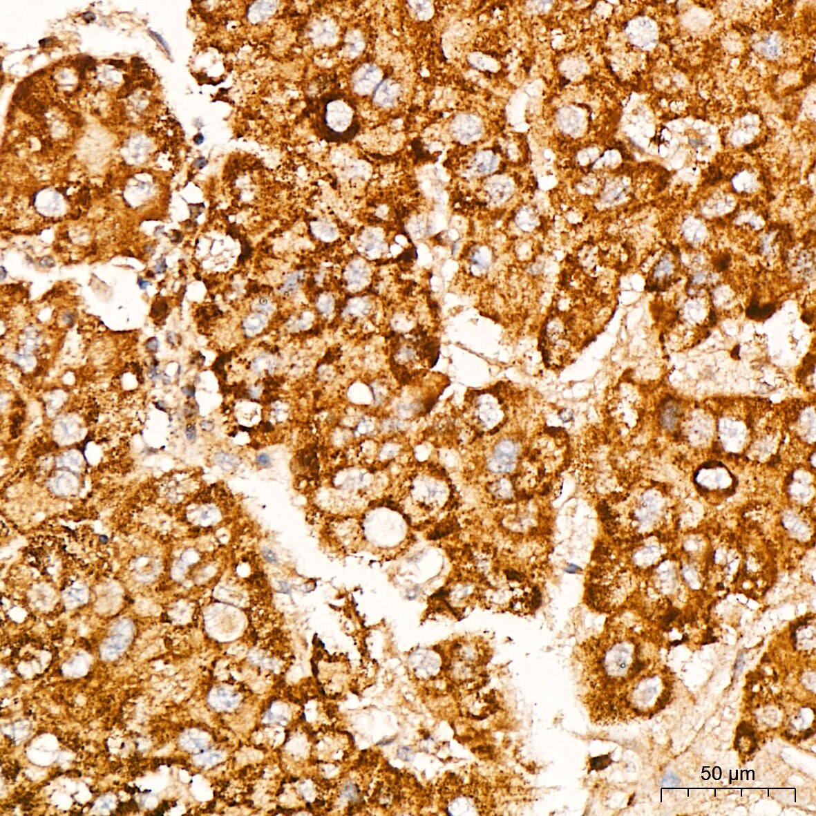 Glutathione Peroxidase 1/GPX1 Antibody (ARC53251)