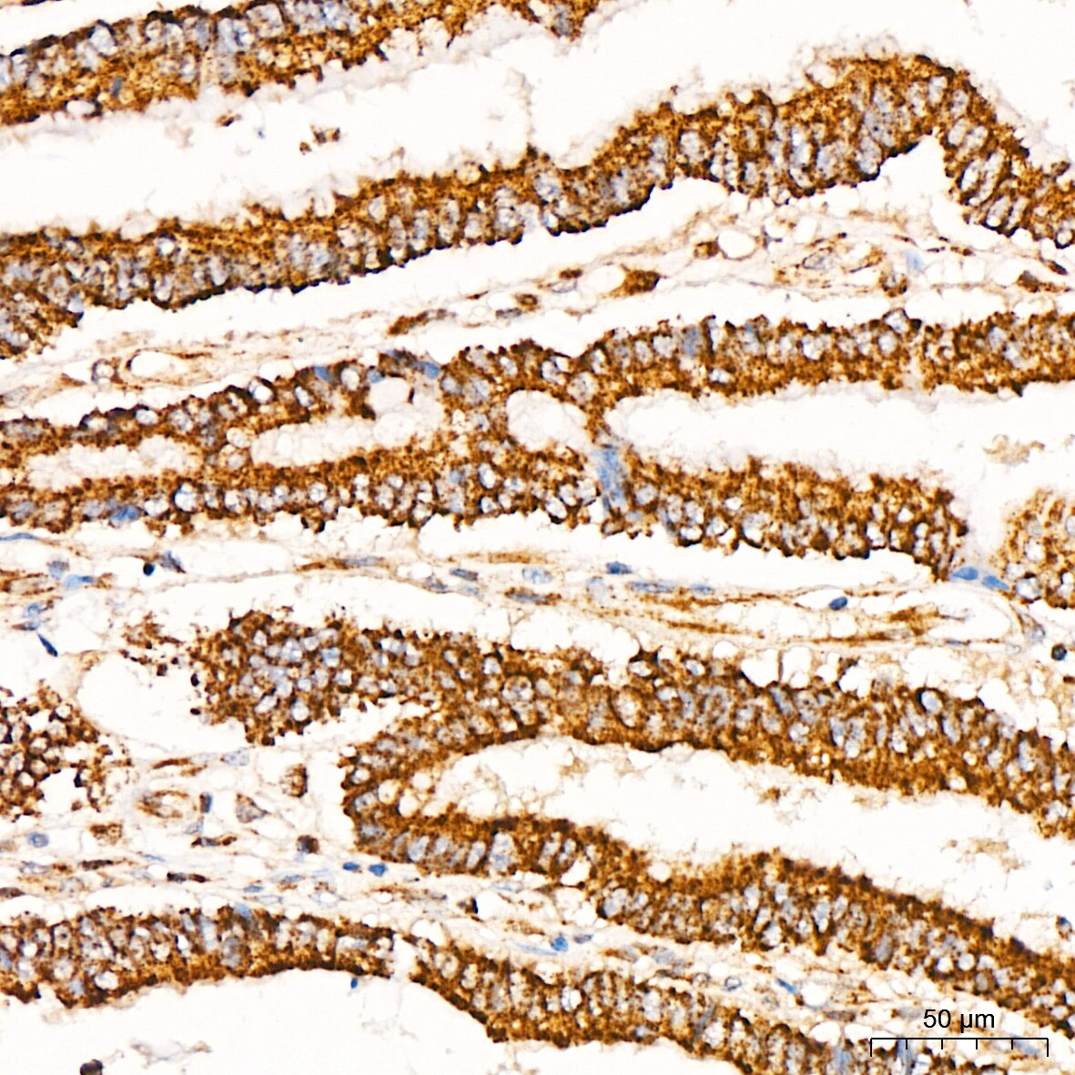 Glutathione Peroxidase 1/GPX1 Antibody (ARC53251)