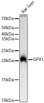 Glutathione Peroxidase 1/GPX1 Antibody (ARC53251)