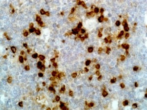 Lambda Light Chain Antibody (RM127) - Azide and BSA Free