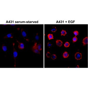 Phospho-Tyrosine Antibody (RM111) - Azide and BSA Free