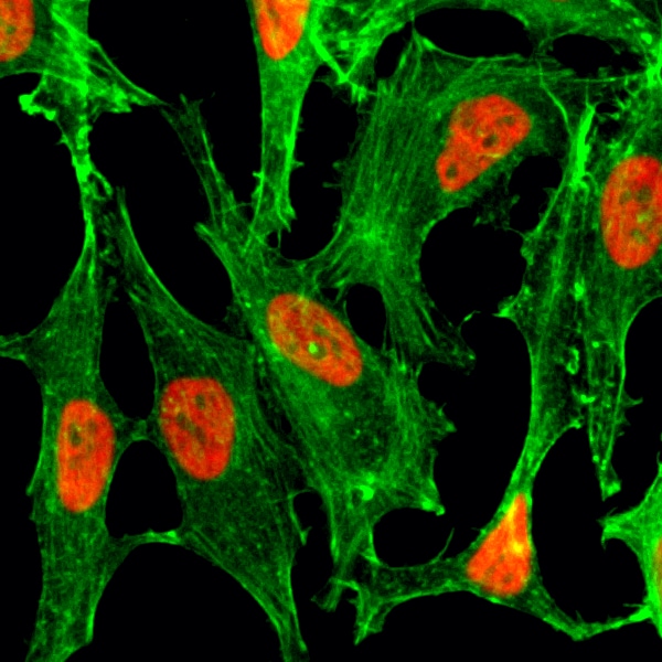 Histone H2B type 1B [ac Lys23] Antibody (RM260) - Azide and BSA Free