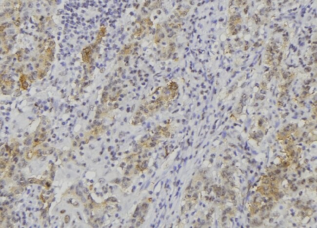 ADAMTS14 Antibody [Unconjugated]