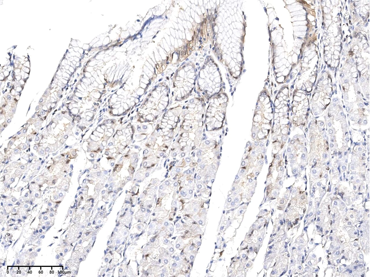 Kallikrein 15 Antibody (02) - Azide and BSA Free