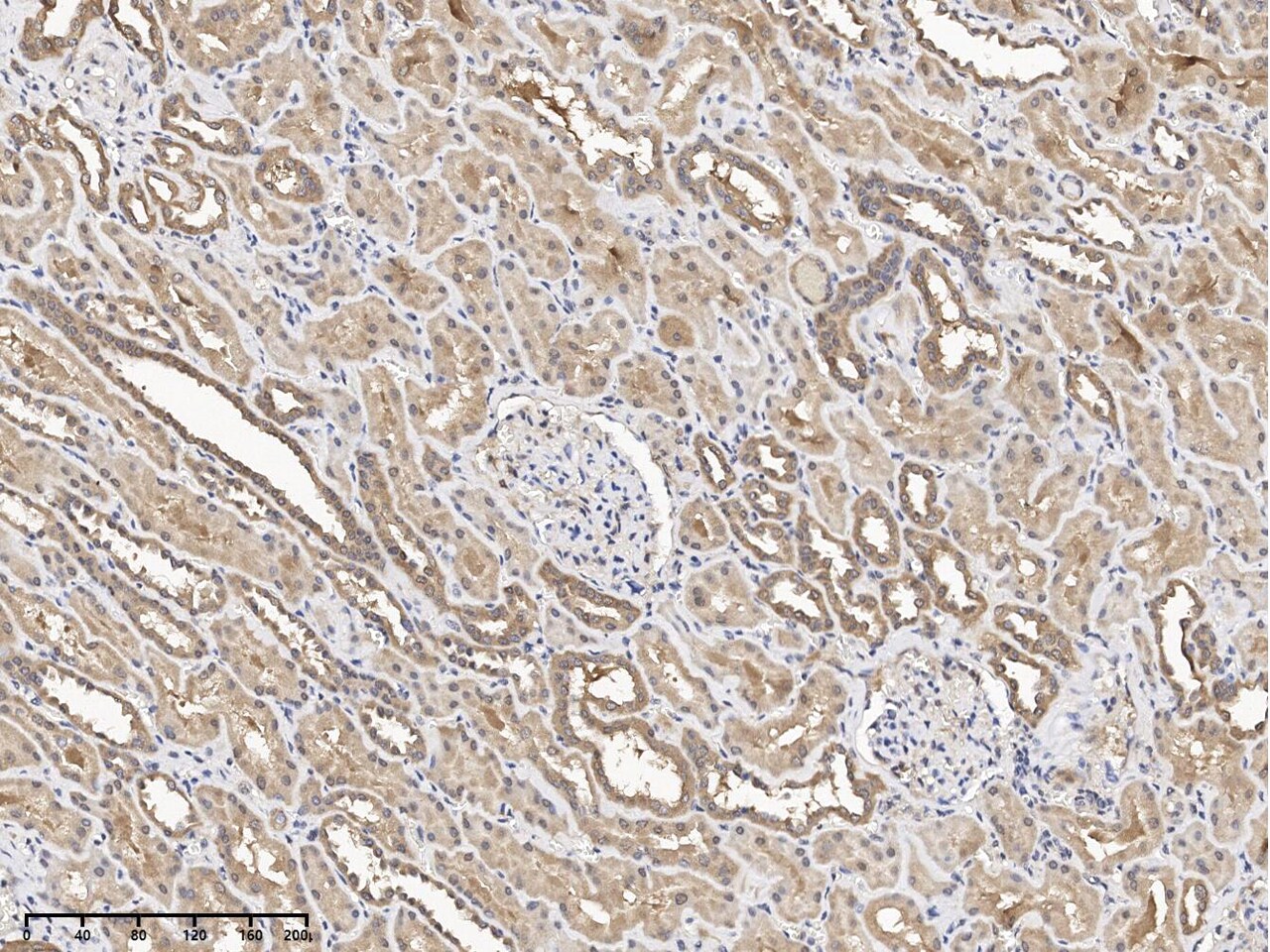 FIGNL1 Antibody - Azide and BSA Free
