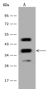 FTSJ1 Antibody - Azide and BSA Free