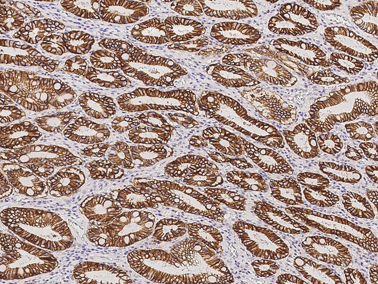 Carbonic Anhydrase IX/CA9 Antibody (09) - Azide and BSA Free