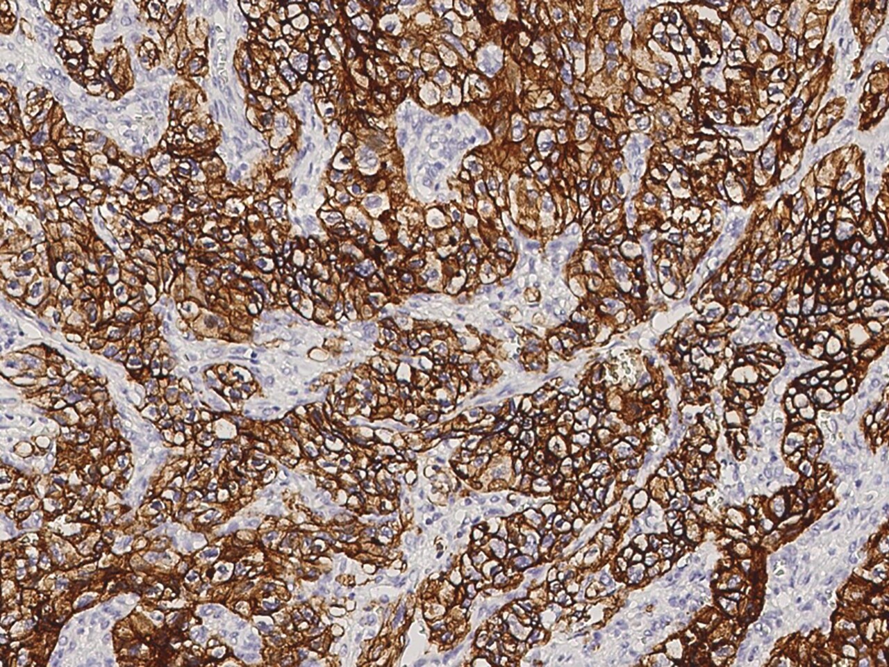 Carbonic Anhydrase IX/CA9 Antibody (09) - Azide and BSA Free