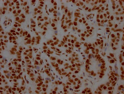 NONO Antibody (8C11)