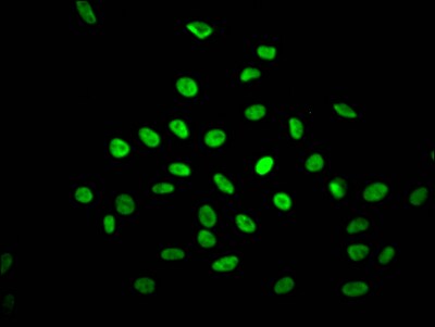 NONO Antibody (8C11)