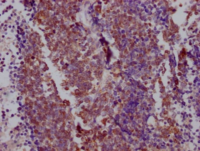 TTF-1 / NKX2-1 Antibody (6C11)