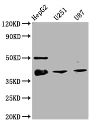 TTF-1 / NKX2-1 Antibody (6C11)