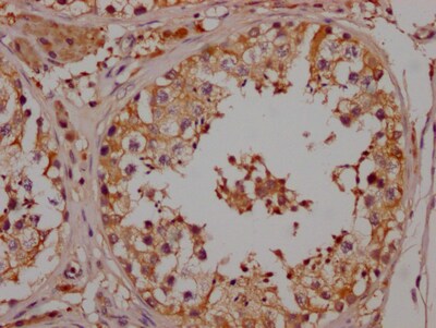 beta-NGF Antibody (5F10)