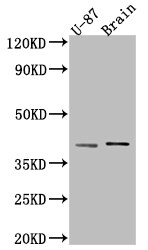 beta-NGF Antibody (5F10)
