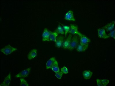 NDRG1 Antibody (4C8)