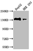 Myosin light chain kinase Antibody (28C5)