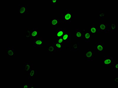MYBBP1A Antibody (3A1)