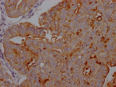 CA125/MUC16 Antibody (10E9)