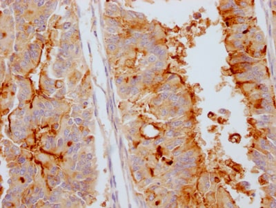 CA125/MUC16 Antibody (10F10)