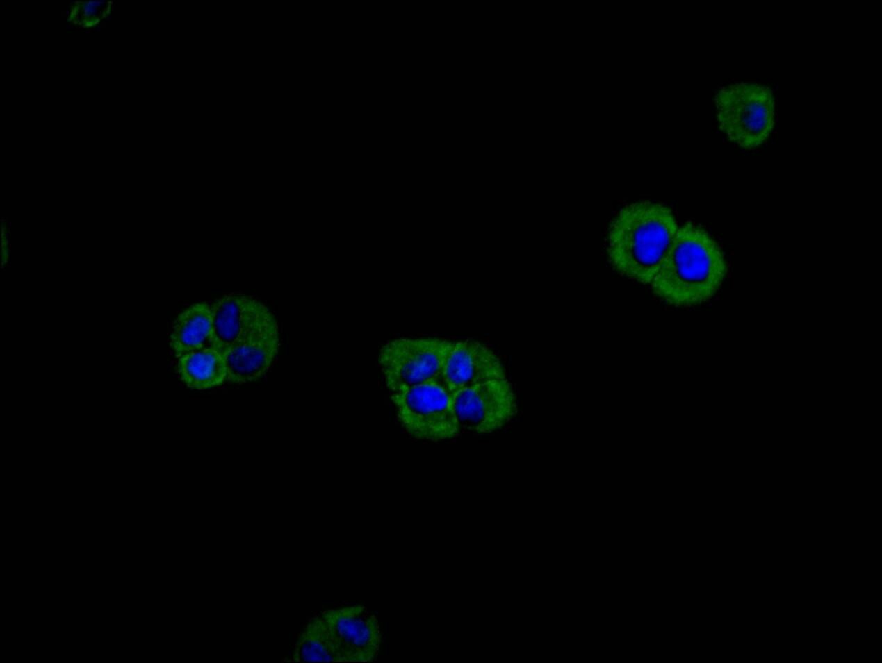 M-Ras/R-Ras3 Antibody (26E12)