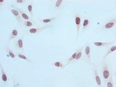 Histone H3.1 [Monomethyl Arg2] Antibody (4G5)