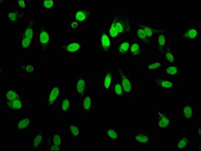 Histone H3.1 [Monomethyl Arg2] Antibody (4G5)