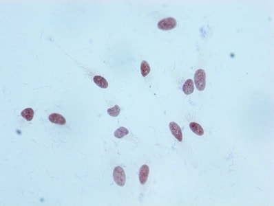 Histone H3.1 [Monomethyl Lys18] Antibody (2B5)
