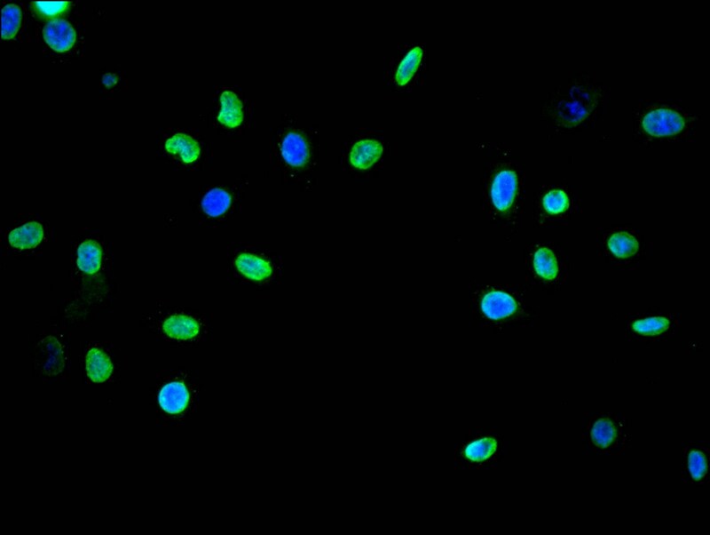 HIST1H3A [Monomethyl Lys9] Antibody (13E1)
