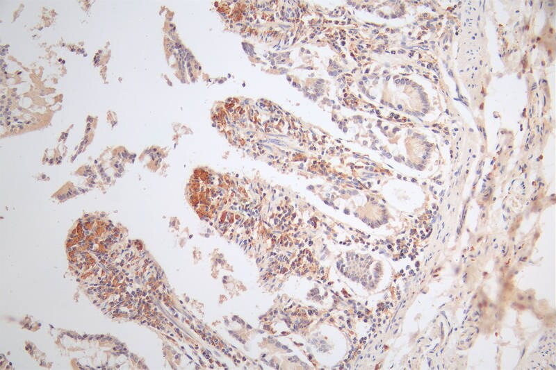 MICA Antibody (9F1)
