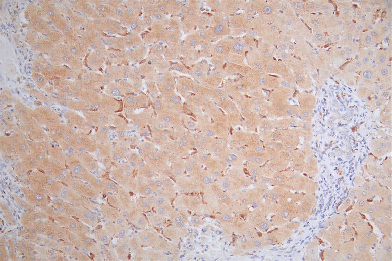MICA Antibody (9F1)