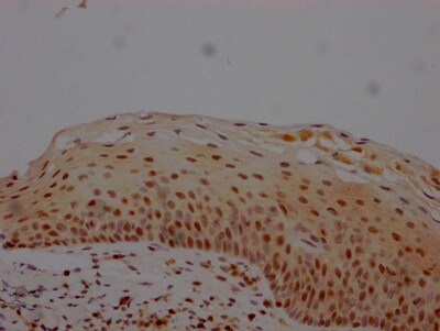 MGMT Antibody (10G7)