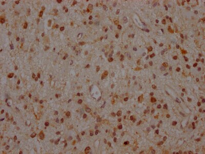 MEK1 Antibody (9B6)