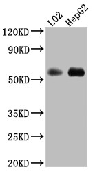 Monoamine Oxidase B Antibody (9B6)